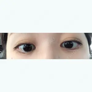 90 days after image