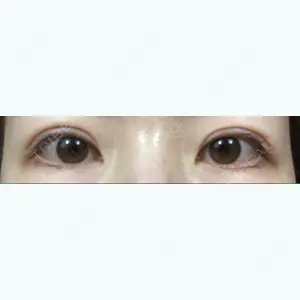 53 days after image