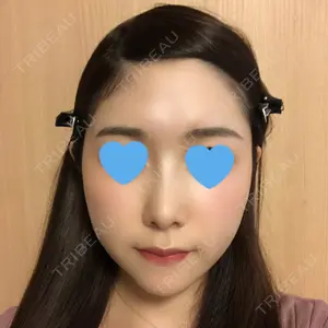 105 days after image