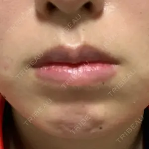 185 days after image