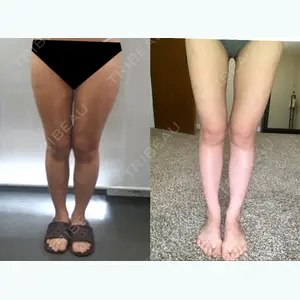 183 days after image