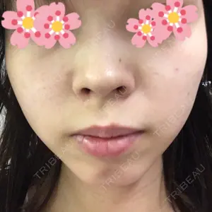10 days after image