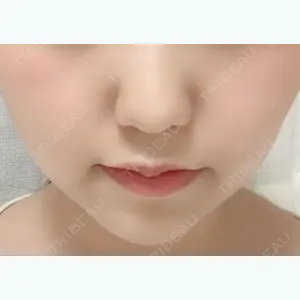107 days after image