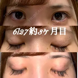 91 days after image