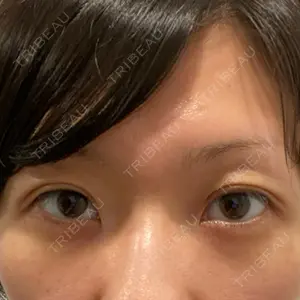 22 days after image