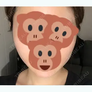 237 days after image