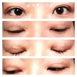 14 days after image