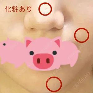 126 days after image