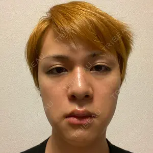 31 days after image