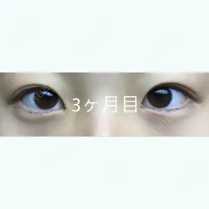 92 days after image