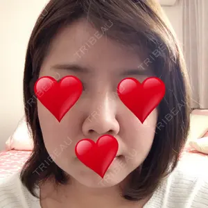 72 days after image
