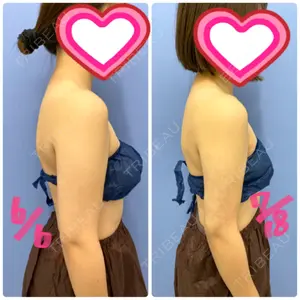 42 days after image