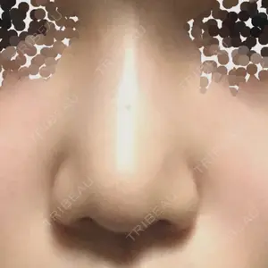 19 days after image