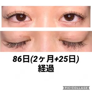 86 days after image