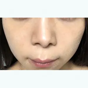 74 days after image