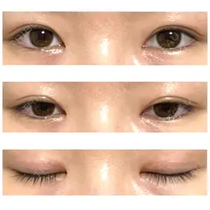 161 days after image