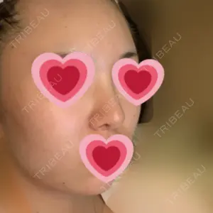85 days after image
