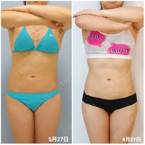 92 days after image