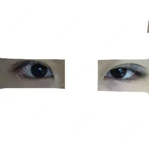 0 days after image