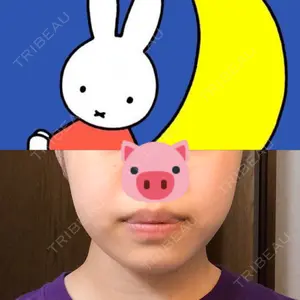 有楽町美容外科クリニック口コミ