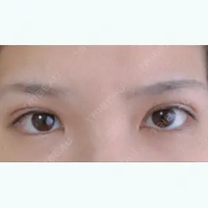 0 days after image