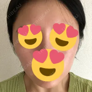 207 days after image