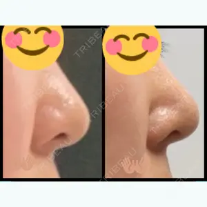 93 days after image