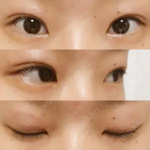 31 days after image