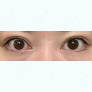 210 days after image