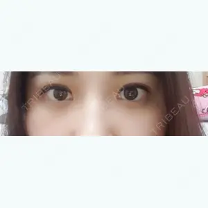139 days after image