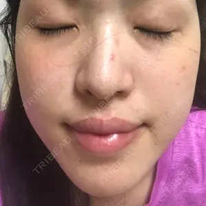 118 days after image
