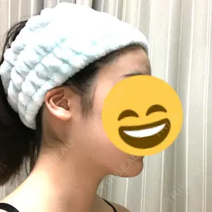 33 days after image