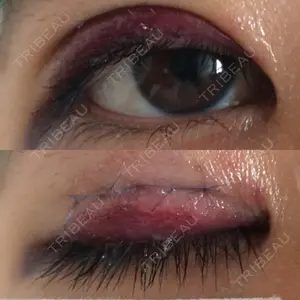 2 days after image