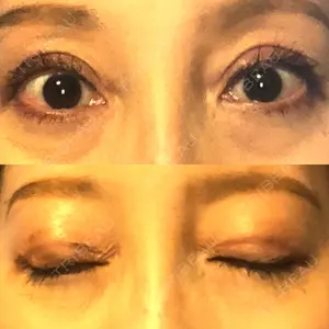 28 days after image