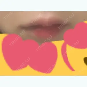 0 days after image