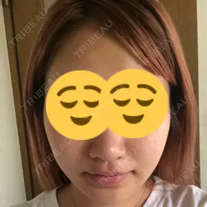 83 days after image