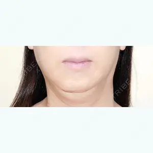 130 days after image