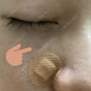132 days after image