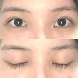 184 days after image