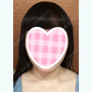 32 days after image