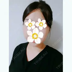 DA美容外科のLEE DONG CHAN医師口コミ