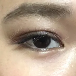 0 days after image