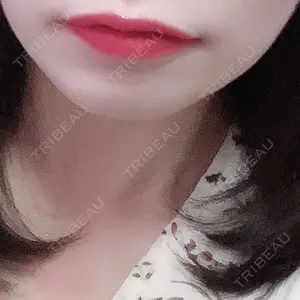 赤井クリニック口コミ