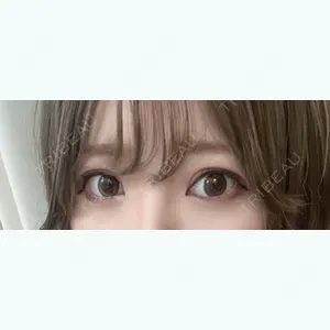 369 days after image