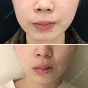 189 days after image