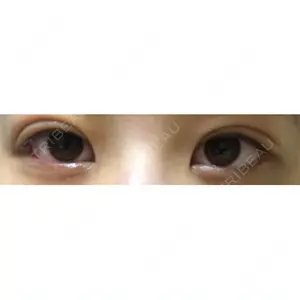 7 days after image