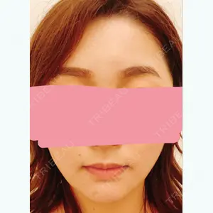 275 days after image
