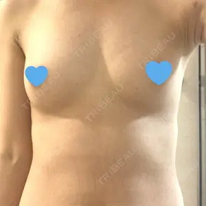 190 days after image