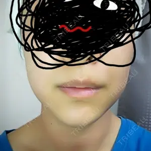 1 days after image