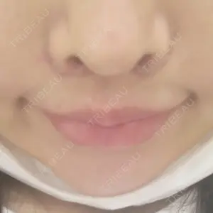 24 days after image